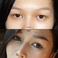 Lovely Eye and Skin Clinic พาร์คเลนเอกมัย
