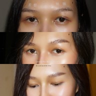 Lovely Eye and Skin Clinic พาร์คเลนเอกมัย