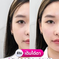 MEGA CLINIC สยามสแควร์