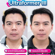 MEGA CLINIC เซ็นทรัลลาดพร้าว ชั้น9