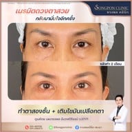 ทรงพลคลินิก โดย คุณหมอทอมมี่