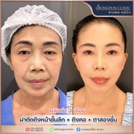 ทรงพลคลินิก โดย คุณหมอทอมมี่