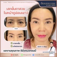 ทรงพลคลินิก โดย คุณหมอทอมมี่