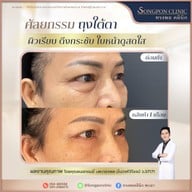 ทรงพลคลินิก โดย คุณหมอทอมมี่