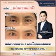 ทรงพลคลินิก โดย คุณหมอทอมมี่