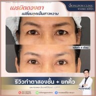 ทรงพลคลินิก โดย คุณหมอทอมมี่