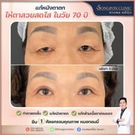 ทรงพลคลินิก โดย คุณหมอทอมมี่