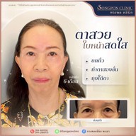 ทรงพลคลินิก โดย คุณหมอทอมมี่