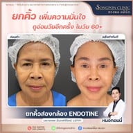 ทรงพลคลินิก โดย คุณหมอทอมมี่