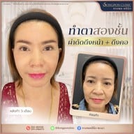 ทรงพลคลินิก โดย คุณหมอทอมมี่