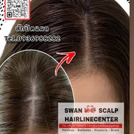 สักหัวล้านสักไรผม สักปิดรอยแผล SwanScalpHairlineCenter Bangkok