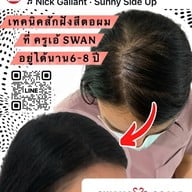 สักหัวล้านสักไรผม สักปิดรอยแผล SwanScalpHairlineCenter Bangkok