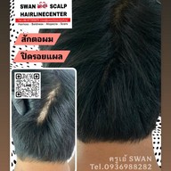 สักหัวล้านสักไรผม สักปิดรอยแผล SwanScalpHairlineCenter Bangkok