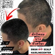 สักหัวล้านสักไรผม สักปิดรอยแผล SwanScalpHairlineCenter Bangkok