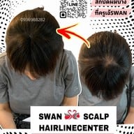 สักหัวล้านสักไรผม สักปิดรอยแผล SwanScalpHairlineCenter Bangkok