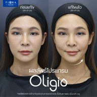 ฟิออร่าคลินิก คลินิก 5 สาขา มหาชัย , กัลปพฤกษ์,  บางนา, อรัญประเทศ และจันทบุรี