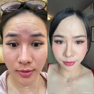 Md Clinic เอ็มดีคลินิก โคราช โคราช