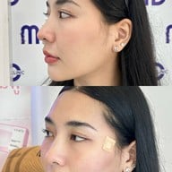 Md Clinic เอ็มดีคลินิก โคราช โคราช