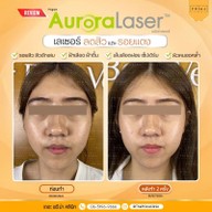 เมนูของร้าน The Prima Clinic Si Racha เดอะ พรีม่า คลินิก ศรีราชา ศรีราชา