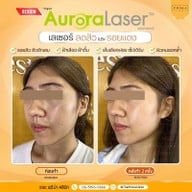 เมนูของร้าน The Prima Clinic Si Racha เดอะ พรีม่า คลินิก ศรีราชา ศรีราชา