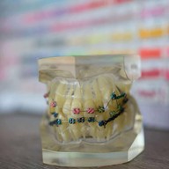 THE LAKE คลินิกทันตกรรม เดอะเลค ทำฟัน จัดฟัน วีเนียร์ รากเทียม รักษารากฟัน ฟอกสีฟัน ทำฟัน จัดฟัน- ขอนแก่น ศรีจันทร์