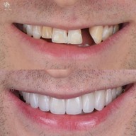 THE LAKE คลินิกทันตกรรม เดอะเลค ทำฟัน จัดฟัน วีเนียร์ รากเทียม รักษารากฟัน ฟอกสีฟัน ทำฟัน จัดฟัน- ขอนแก่น ศรีจันทร์