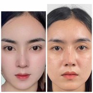 แกรนด์มาสเตอร์ คลินิก