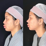 DSC CLINIC สาขาบางแสน บางแสน