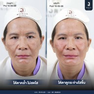 เมนูของร้าน MHORJIK Clinic
