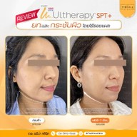 เมนูของร้าน The Prima Clinic Si Racha เดอะ พรีม่า คลินิก ศรีราชา ศรีราชา