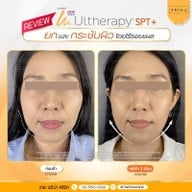 เมนูของร้าน The Prima Clinic Si Racha เดอะ พรีม่า คลินิก ศรีราชา ศรีราชา