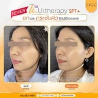 เมนูของร้าน The Prima Clinic Si Racha เดอะ พรีม่า คลินิก ศรีราชา ศรีราชา