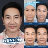 Bright Vision Clinic