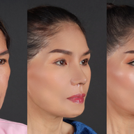 โรงพยาบาลเลอลักษณ์  (LELUX Hospital)