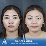 เมนูของร้าน ATTITUDE CLINIC เชียงใหม่