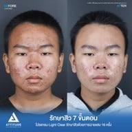 เมนูของร้าน Attitude Clinic ลำปาง