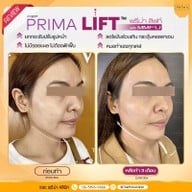 เมนูของร้าน The Prima Clinic Si Racha เดอะ พรีม่า คลินิก ศรีราชา ศรีราชา