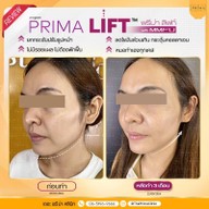 เมนูของร้าน The Prima Clinic Si Racha เดอะ พรีม่า คลินิก ศรีราชา ศรีราชา