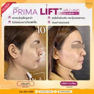เมนูของร้าน The Prima Clinic Si Racha เดอะ พรีม่า คลินิก ศรีราชา ศรีราชา