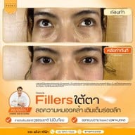 เมนูของร้าน The Prima Clinic Si Racha เดอะ พรีม่า คลินิก ศรีราชา ศรีราชา