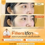 เมนูของร้าน The Prima Clinic Si Racha เดอะ พรีม่า คลินิก ศรีราชา ศรีราชา