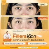เมนูของร้าน The Prima Clinic Si Racha เดอะ พรีม่า คลินิก ศรีราชา ศรีราชา