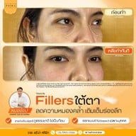 เมนูของร้าน The Prima Clinic Si Racha เดอะ พรีม่า คลินิก ศรีราชา ศรีราชา