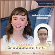 ทรงพลคลินิก โดย คุณหมอทอมมี่