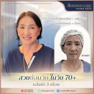 ทรงพลคลินิก โดย คุณหมอทอมมี่