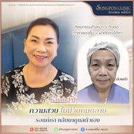 ทรงพลคลินิก โดย คุณหมอทอมมี่