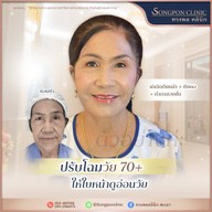 ทรงพลคลินิก โดย คุณหมอทอมมี่