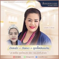 ทรงพลคลินิก โดย คุณหมอทอมมี่
