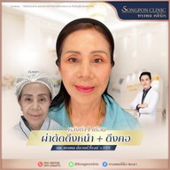 ทรงพลคลินิก โดย คุณหมอทอมมี่