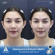 เมนูของร้าน Attitude Clinic  ห้วยขวาง